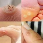 3 Diseases You May Face If You Never Leave a Charger Plugged In When Empty