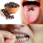 Holding Cloves in Your Mouth: A Natural Way to Relieve Toothache