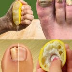 5 groups of people who should avoid avocado, no matter how much they crave it